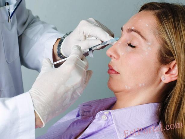 Проблема неэффективности лечения и иммунорезистентности в ботулинотерапии