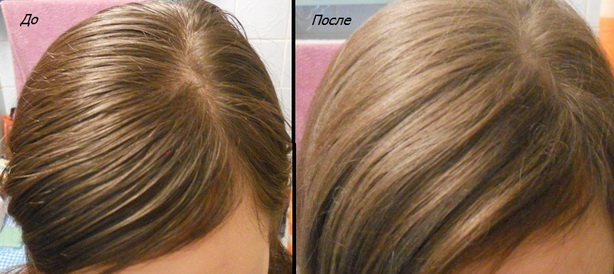 Сухой шампунь и выпадение волос • EstPortal