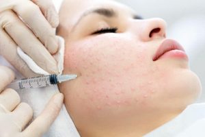 Мезотерапия: наступление или отступление?